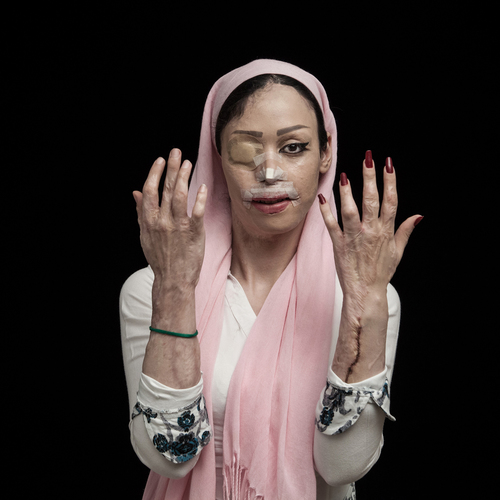 Асгар Хамсех (Asghar Khamseh), Иран. Фотограф года.
«Огонь ненавести». / SWPA 2016. Профессиональный конкурс. Призеры